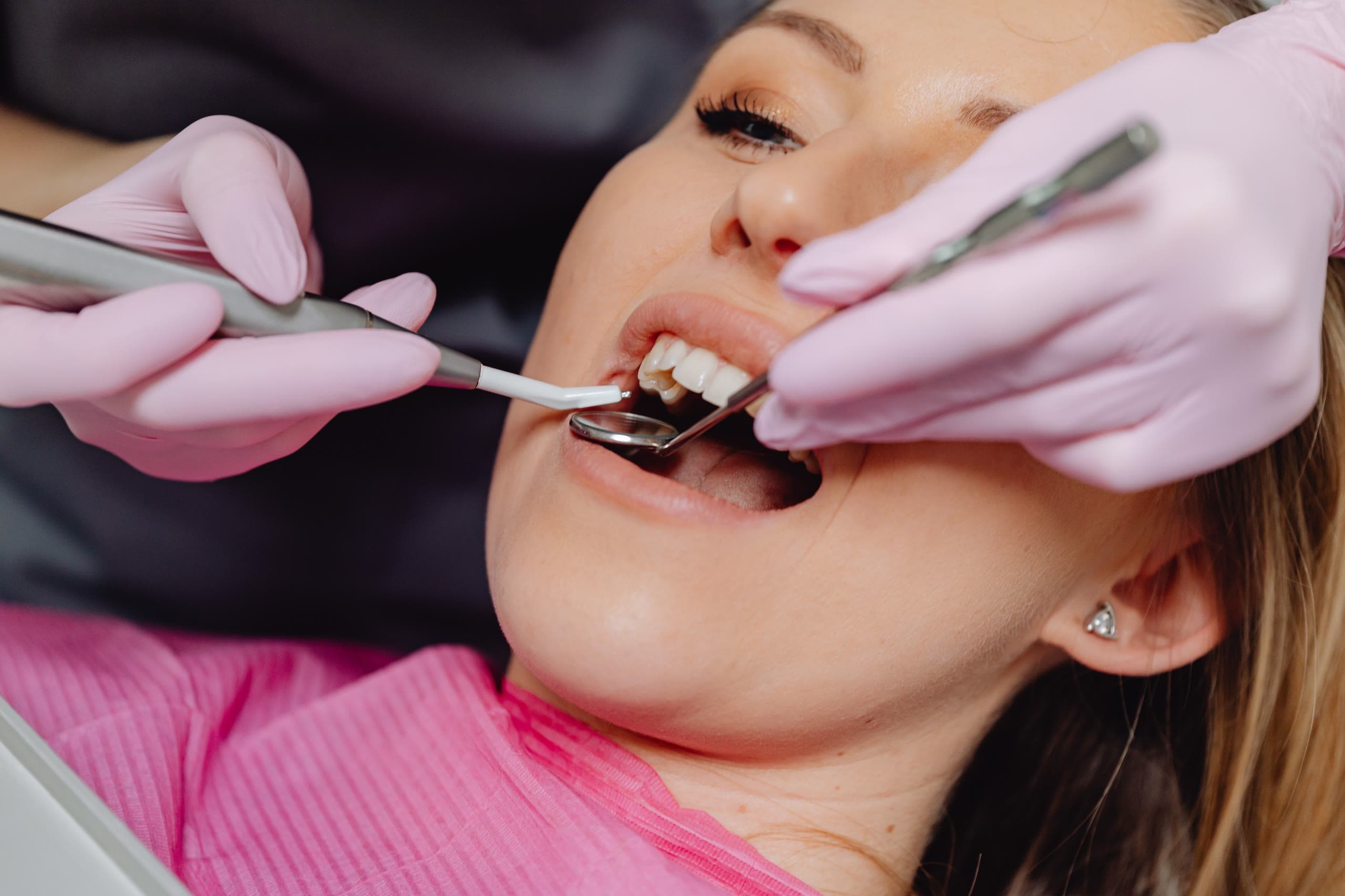 Trattamento in corso su un dente dell'arcata superiore, con manipolo e specchietto