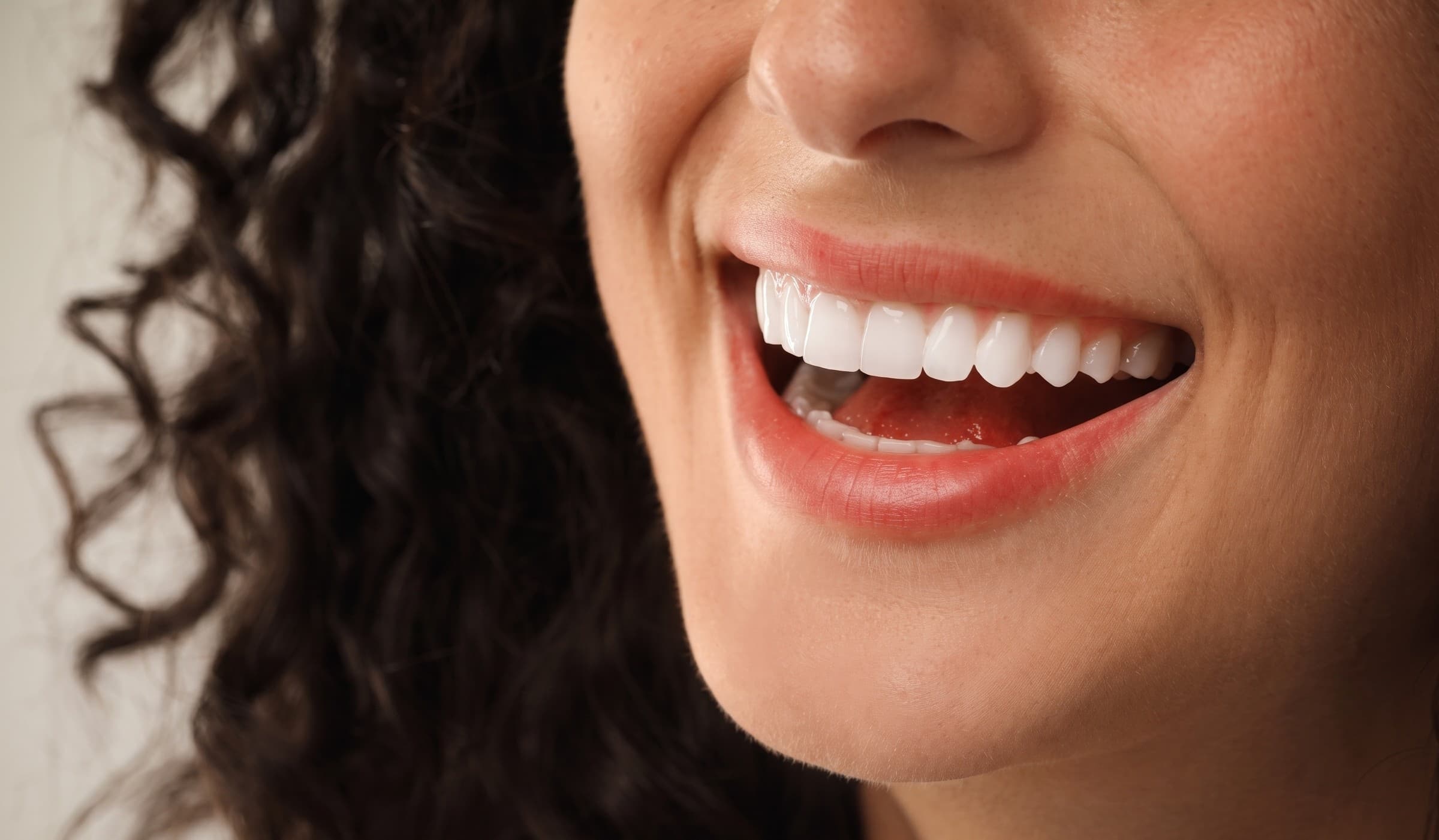 Sorriso luminoso dopo un trattamento estetico eseguito in studio